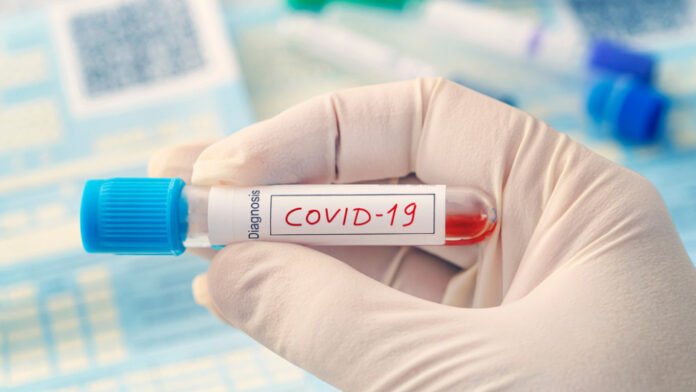 st-covidblood